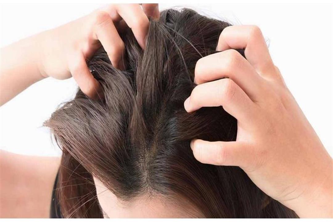 التهاب بصيلات الشعر.. كيف يمكن علاجه؟