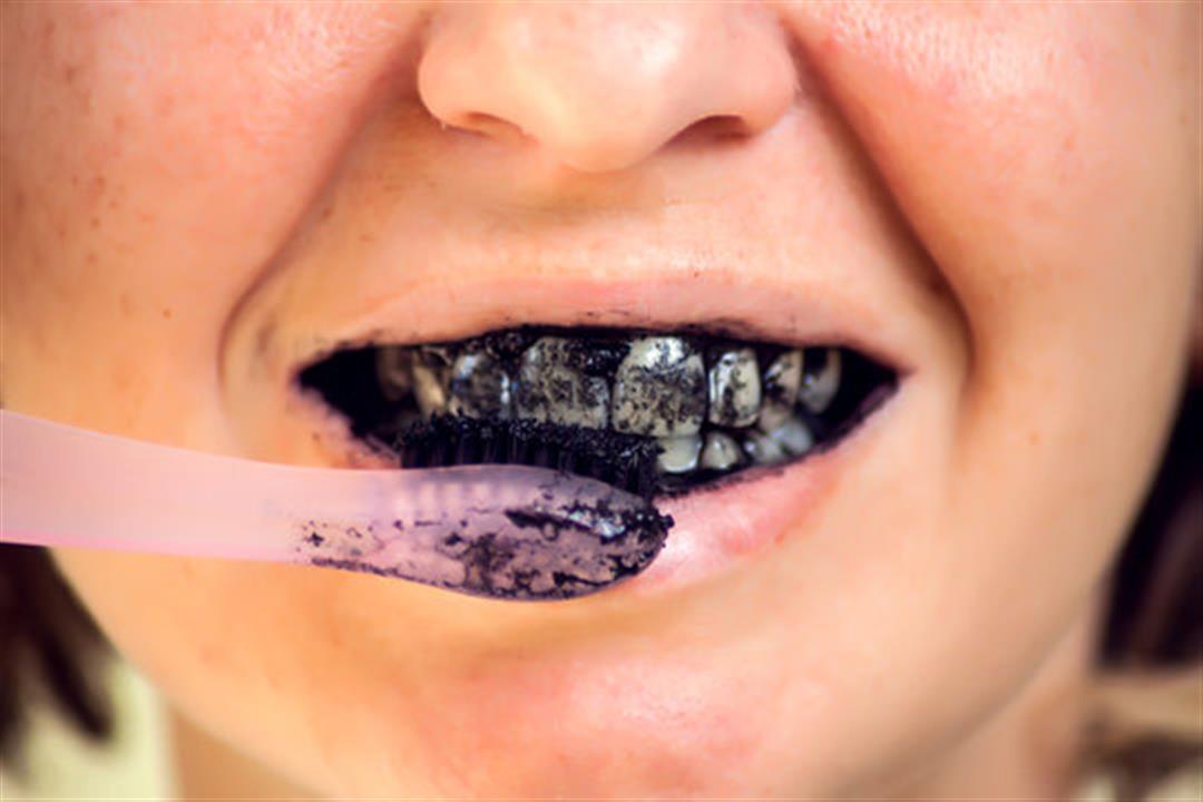 تبييض الأسنان بالفحم- حقيقة أم خرافة؟
