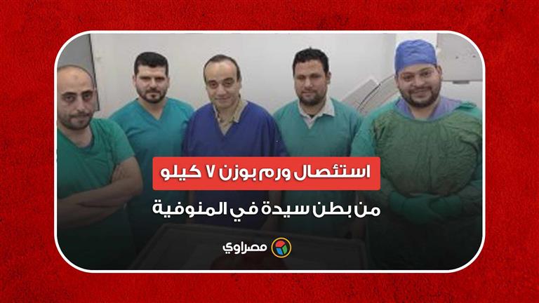 عمرها 84 عامًا.. استئصال ورم بوزن 7 كيلو من بطن سيدة في المنوفية