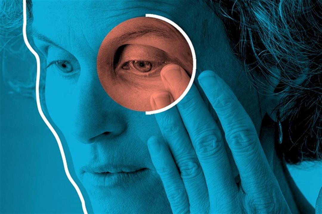 أعراض فرط نشاط الغدة الدرقية- 6 علامات تظهر في العين