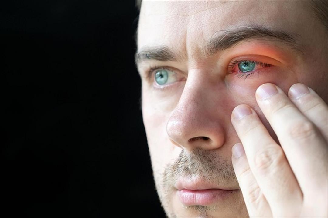 الموجة الحارة- نصائح بسيطة للتعامل مع أمراض العيون