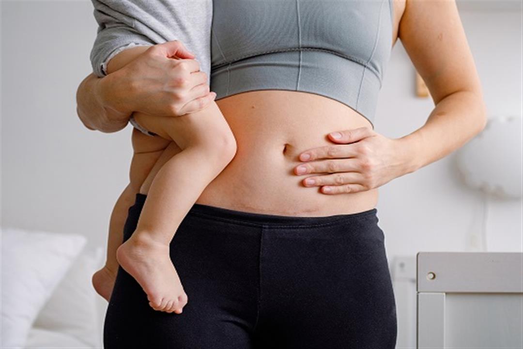 بعد الولادة القيصرية- 10 علامات تكشف أن حياتِك في خطر