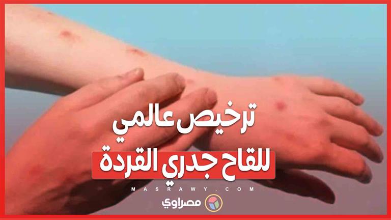 لقاح "إم بوكس" يحصل على ترخيص عالمي.. خطوة جديدة في مكافحة جدري القردة