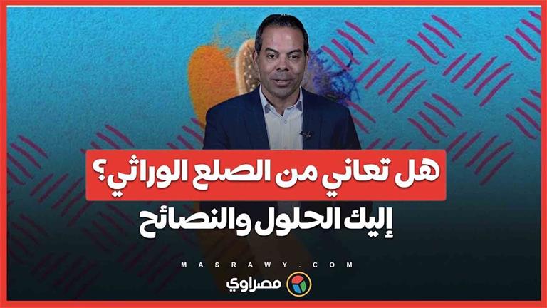 هل تعاني من الصلع الوراثي؟ إليك الحلول والنصائح