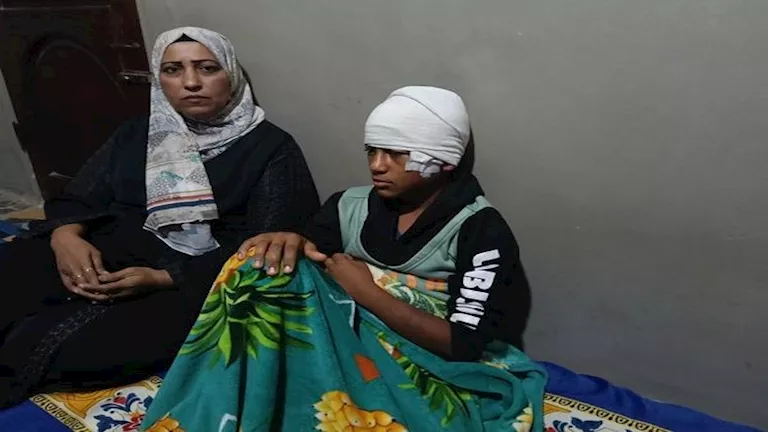 “40 غرزة في وجهه”.. أم تتهم أطفالًا بتمزيق وجه ابنها بالشرقية