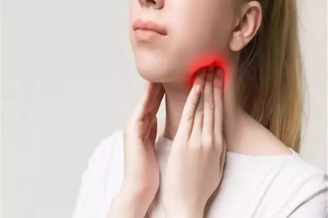 ألم الحلق