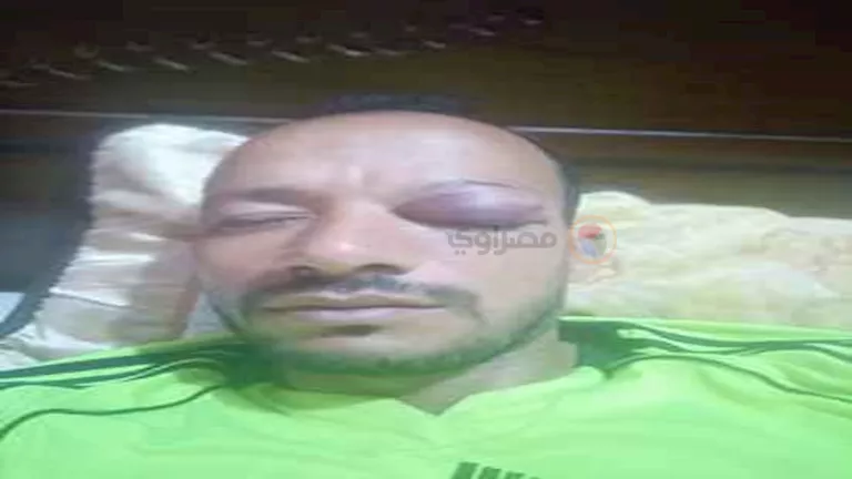 خناقة نادي الشيخ زايد.. موظف بنادٍ كرة قدم شهير يصيب مدرب بزلطة والضحية: ضربني في نص الملعب