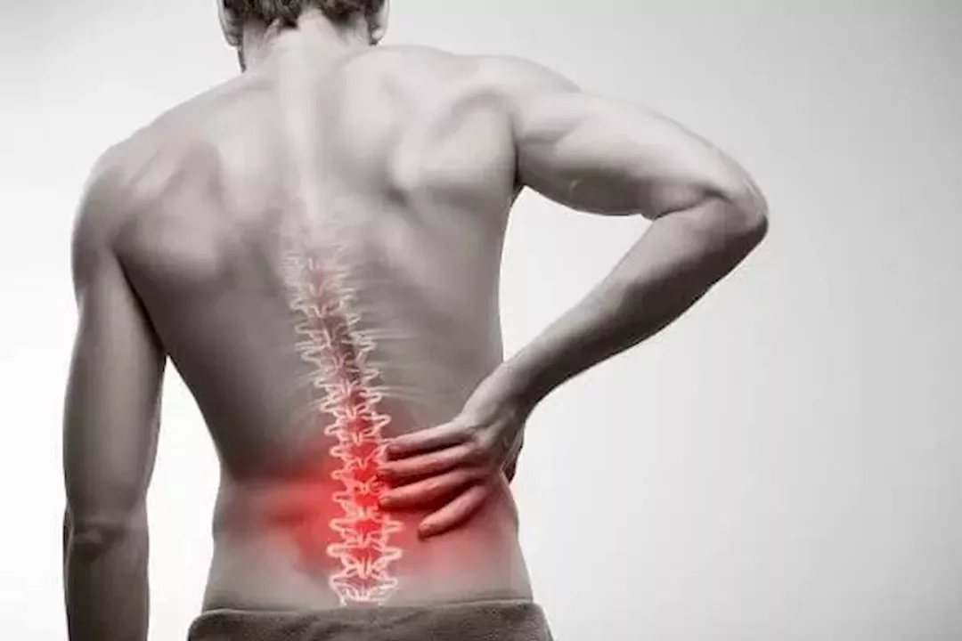 علاج آلام الظهر بزيت اللوز- هل يحقق نتائج فعالة؟ 