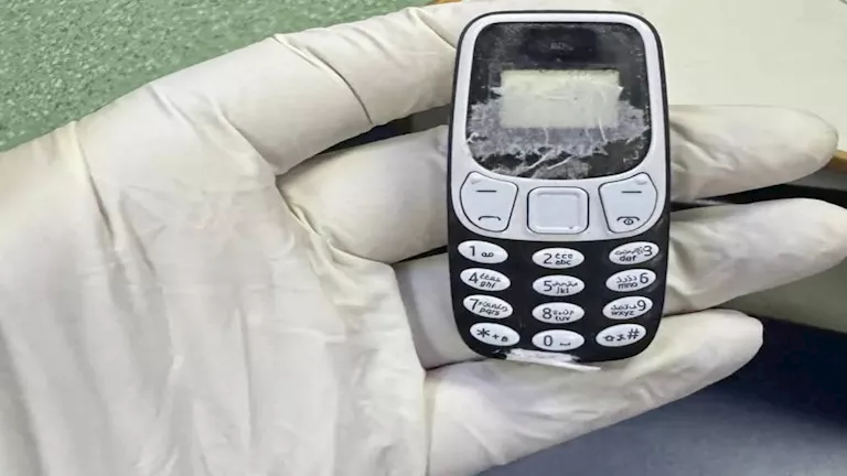 بعد 11 شهرًا.. استخراج هاتف محمول من معدة مريض بالمنصورة (صور)