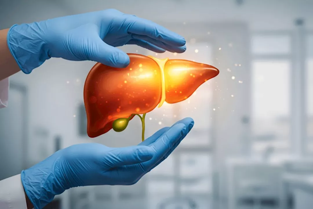 الكبد الدهني