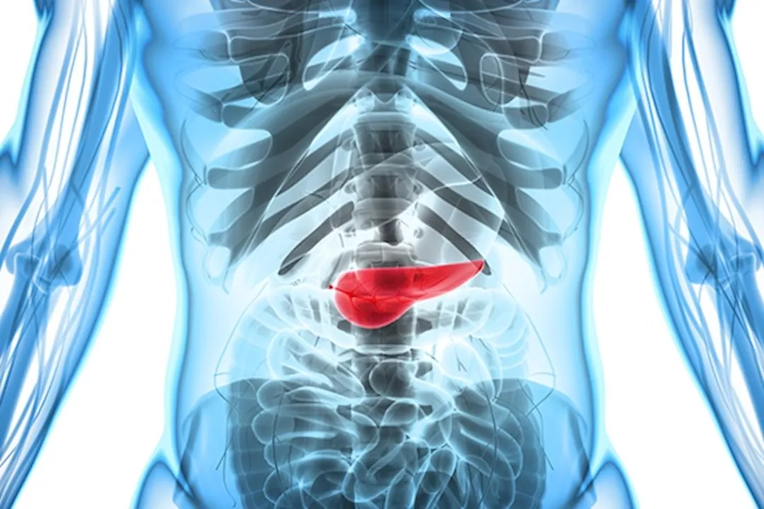 التهاب أو سرطان- 5 أعراض مبكرة تخبرك بأن بنكرياسك مريض