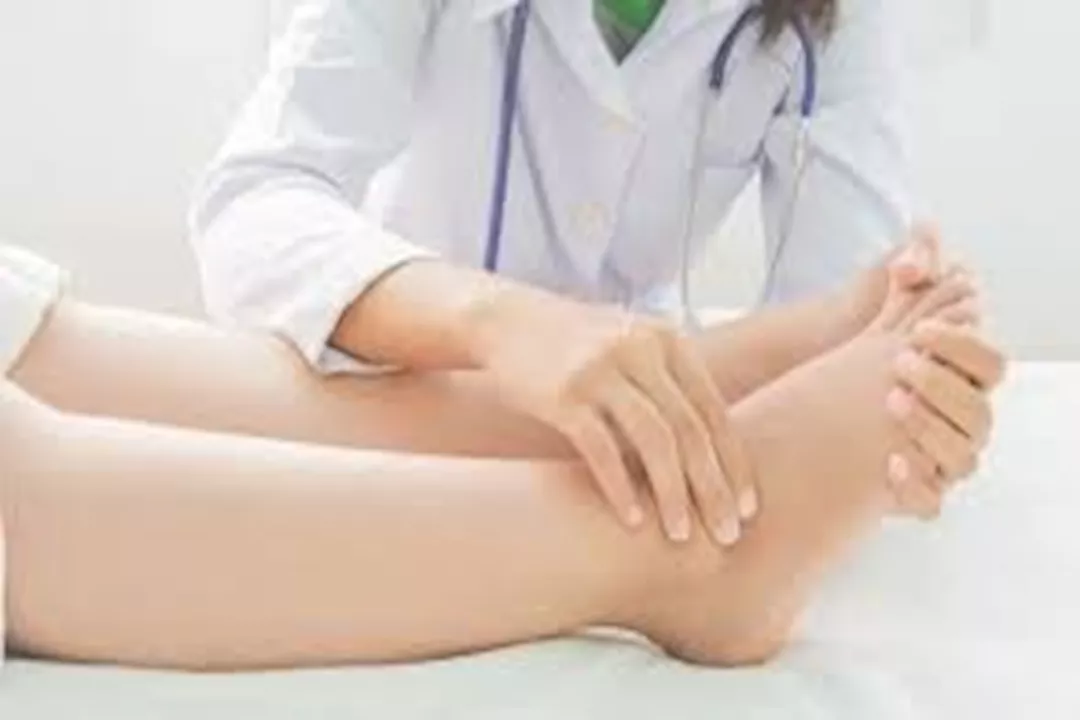 تورم القدمين