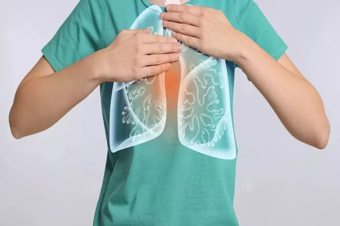 أعراض ماء الرئة