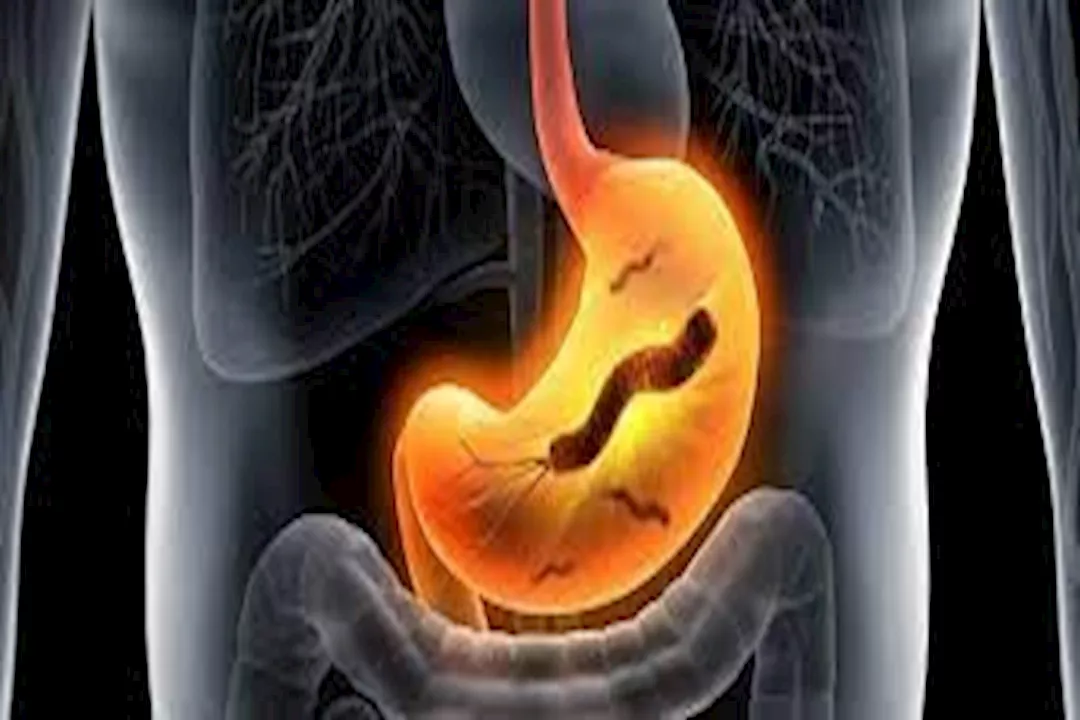 جرثومة المعدة