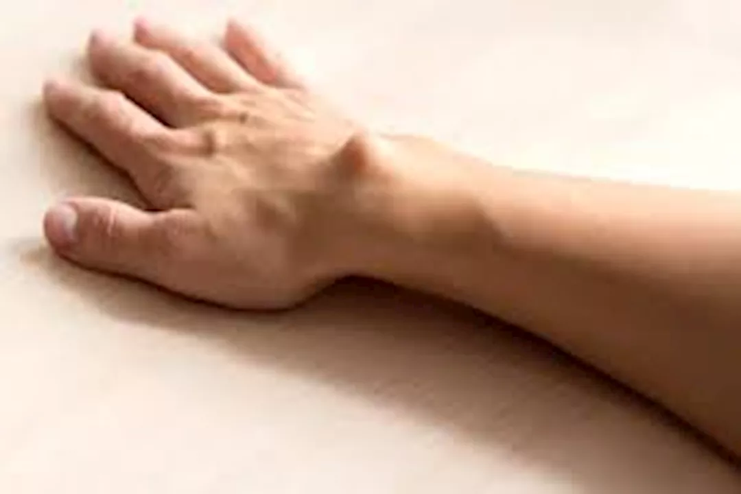 تورم مفصل اليد