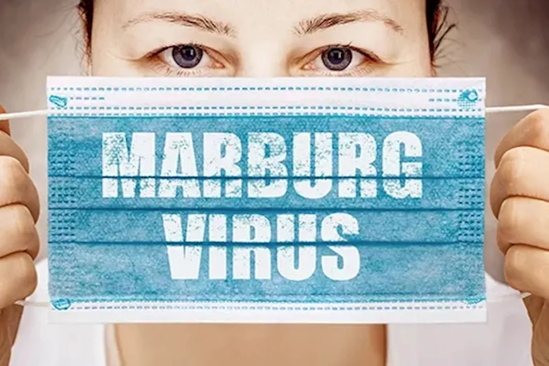 فيروس ماربورغ 