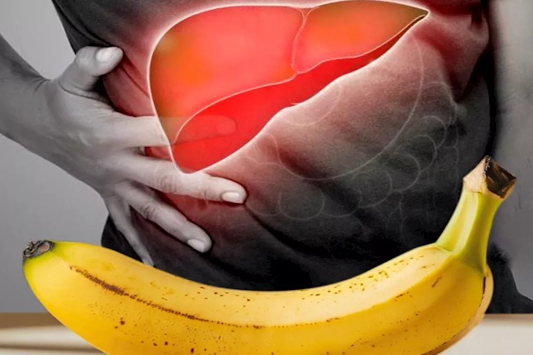 الموز للكبد