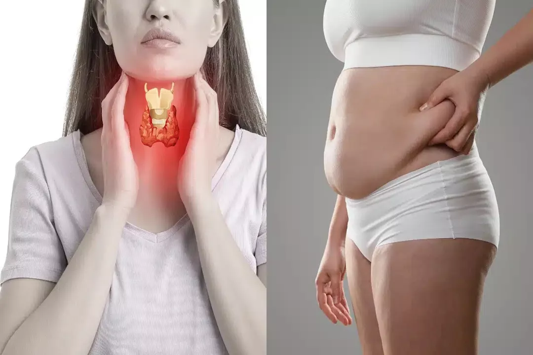 علاقة الغدة الدرقية بزيادة الوزن