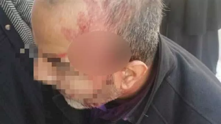 محامِ المتهم بضرب معلم الإسماعيلية: موكلي دافع عن نفسه -فيديو