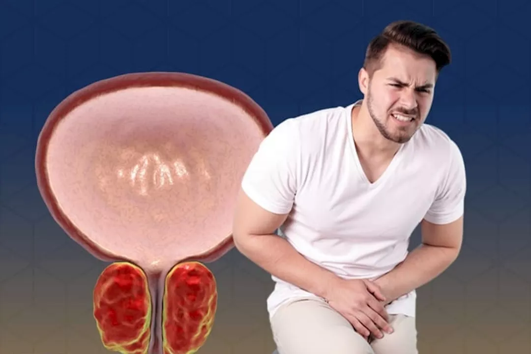 هل احتقان البروستاتا يمكن أن تتسبب في الالتهابات؟.. طبيب