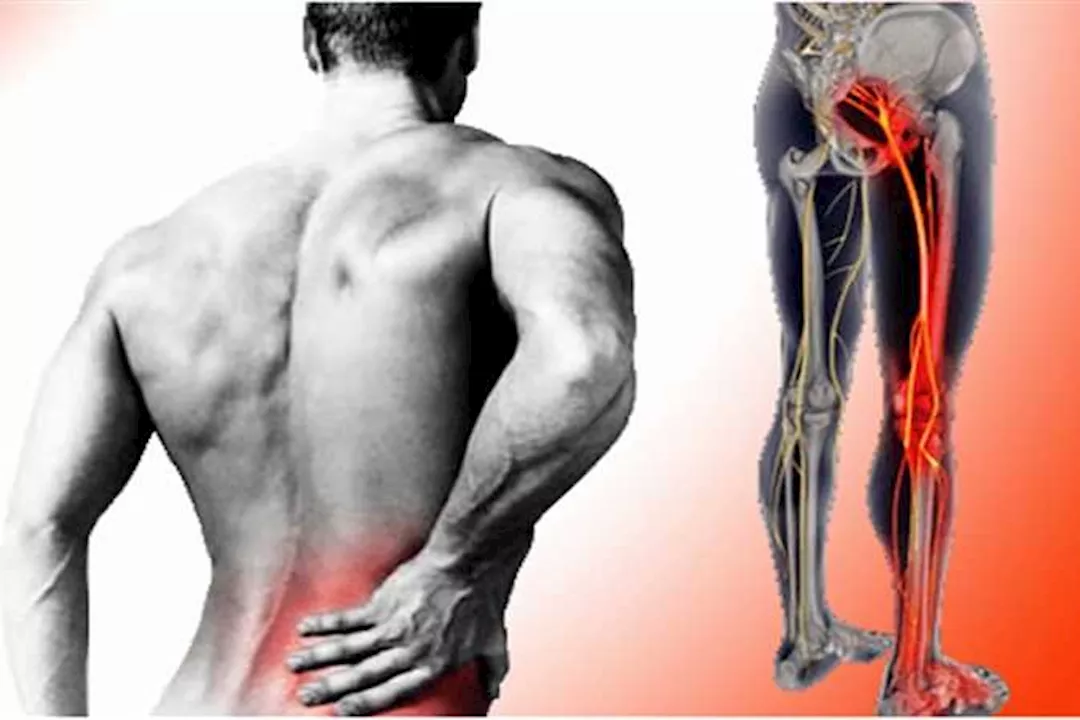 عرق النسا وسقوط القدم.. طبيب يوضح العلاقة بينهما