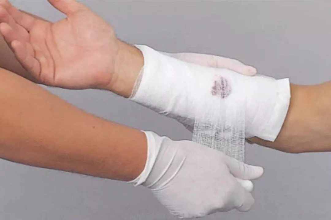 إسعافات أولية للقطع الوريدي.. وكيفية وقف النزيف؟ طبيب يوضح 