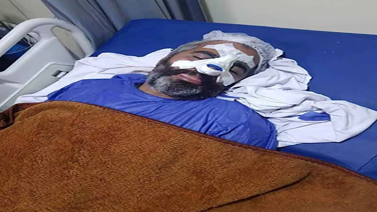 “شرخ بالضلع و8 غرز”.. مدرب أبو قير يكشف لمصراوي كواليس اشتباك الترسانة