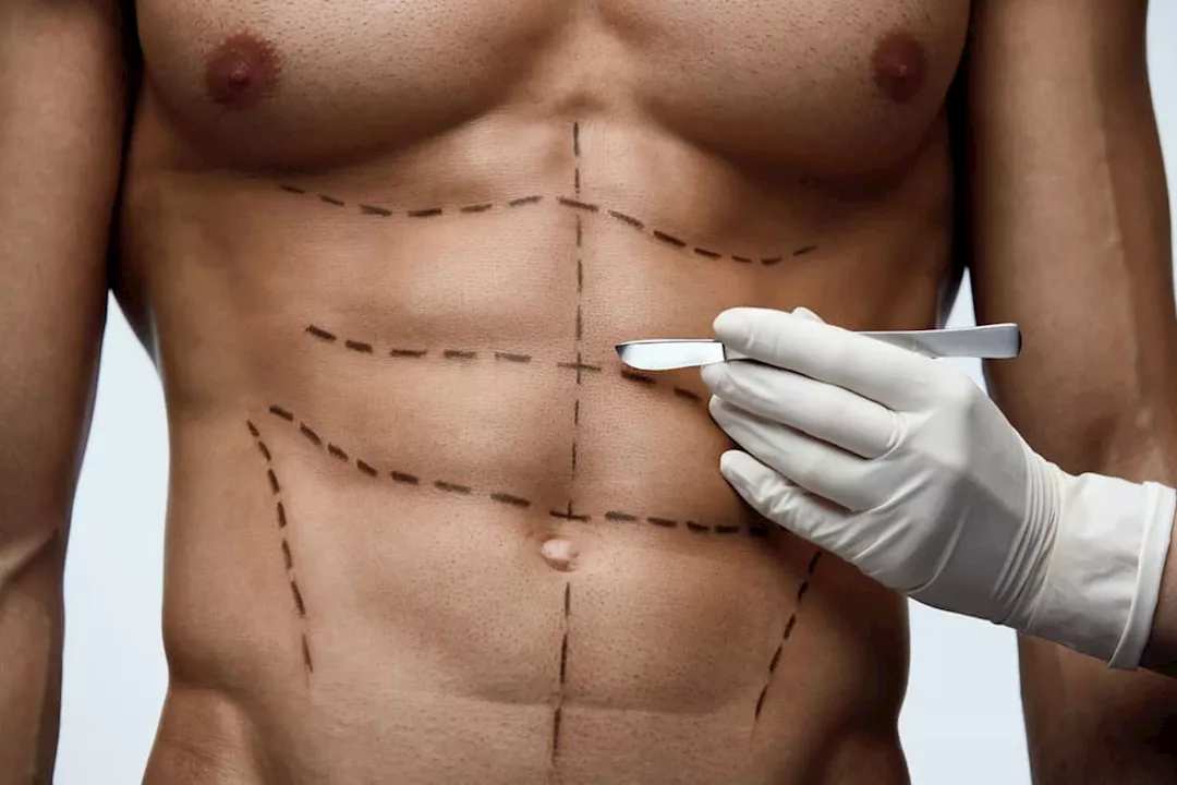 عمليات نحت الجسم