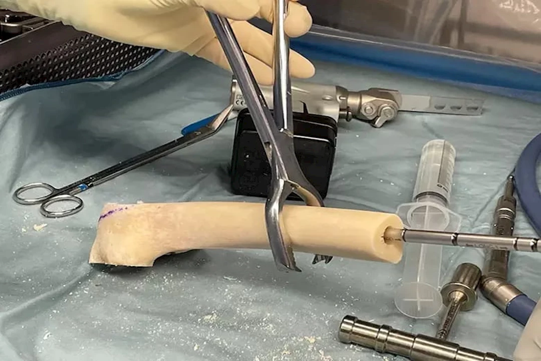 جانب من العملية (3)