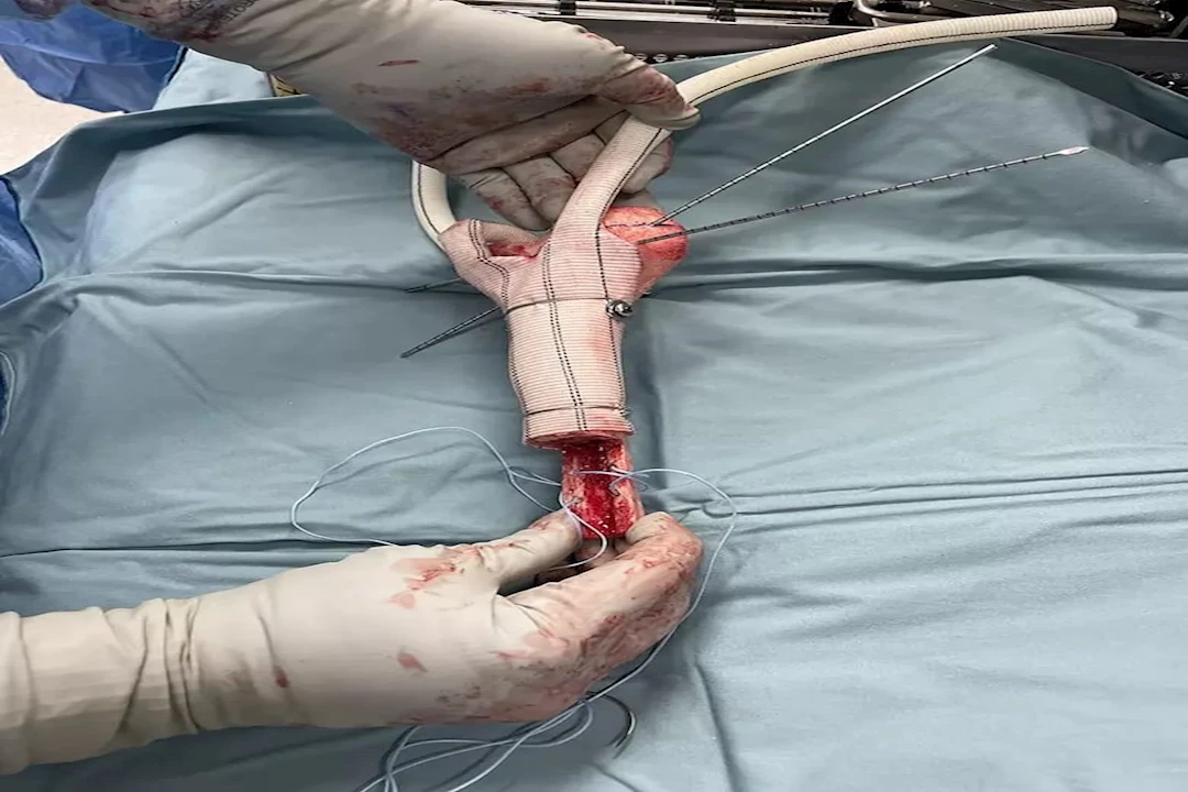 جانب من العملية (2)