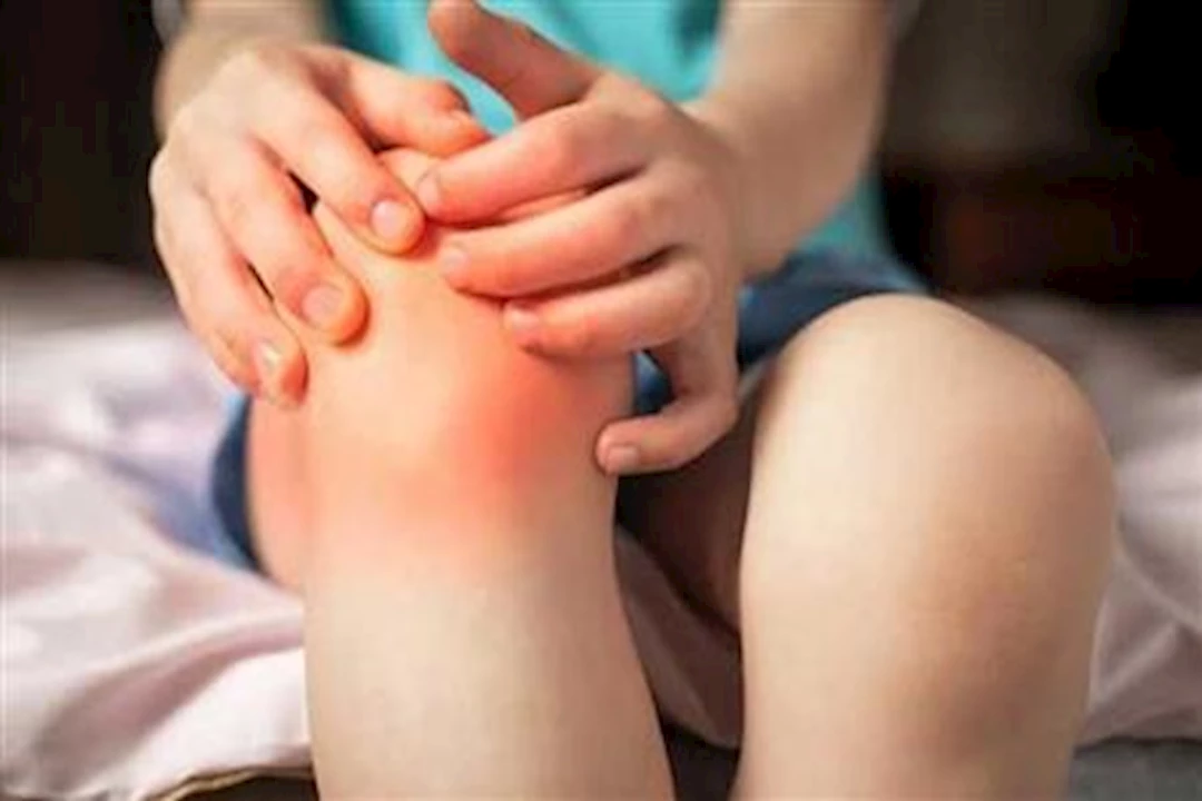 ما هى علامات التهاب المفاصل عند الأطفال؟