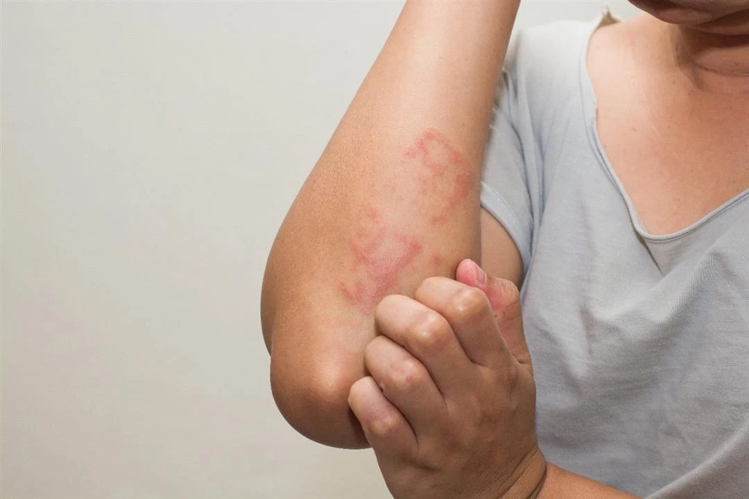 مرض معدي بين الأطفال.. احذر أعراضه وأسبابه