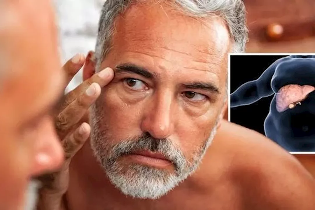 أعراض دهون الكبد على الوجه