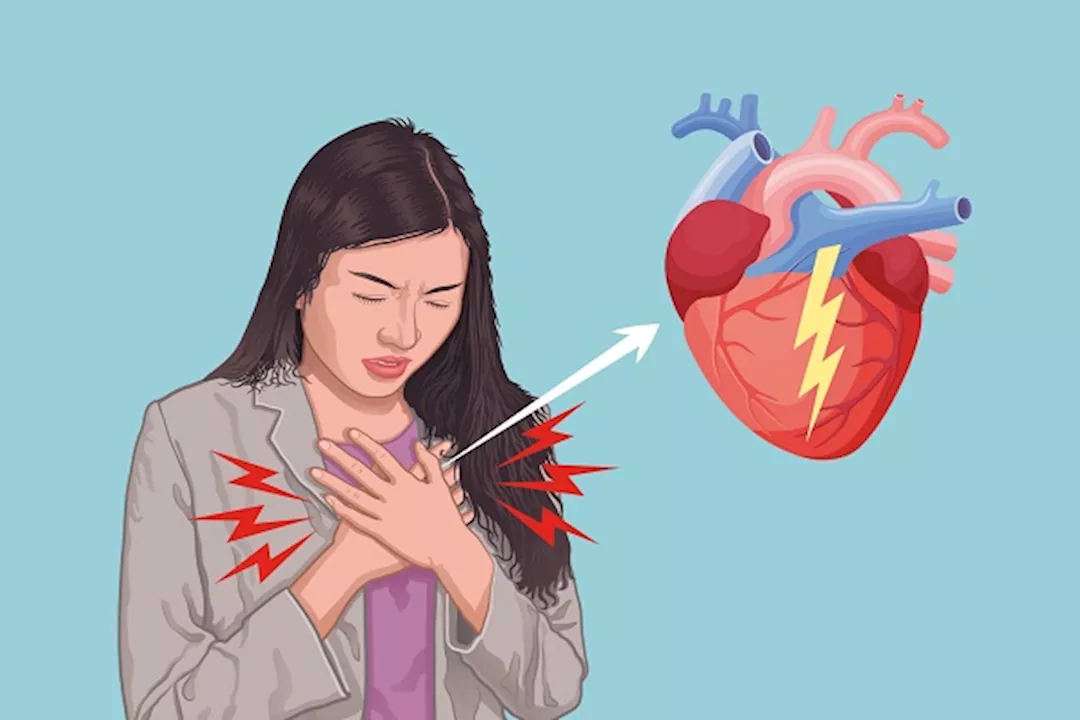 نغزات القلب - طبيب يوضح لماذا النساء الأكثر عرضة لها؟ 