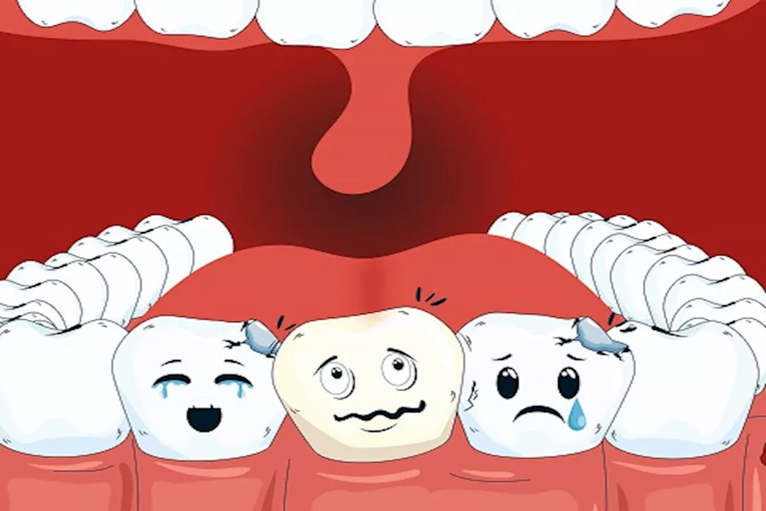 سوء نظافة الأسنان