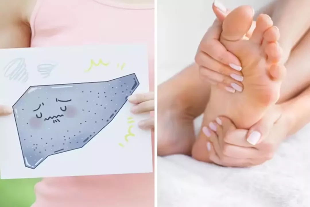 أعراض أمراض الكبد على اليدين والقدمين