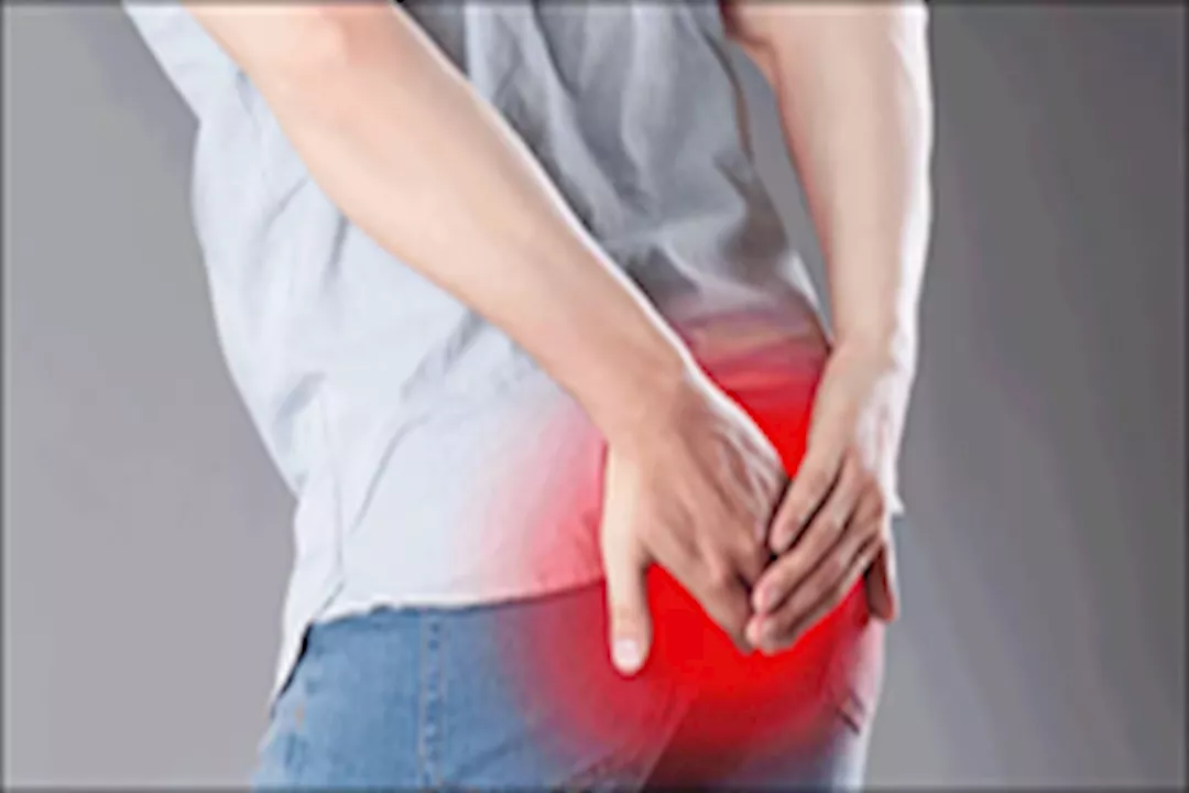  الحكة الشرجية 