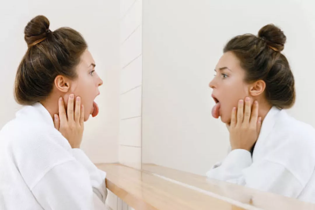 كيف يخبرك لسانك بأنك مريض؟