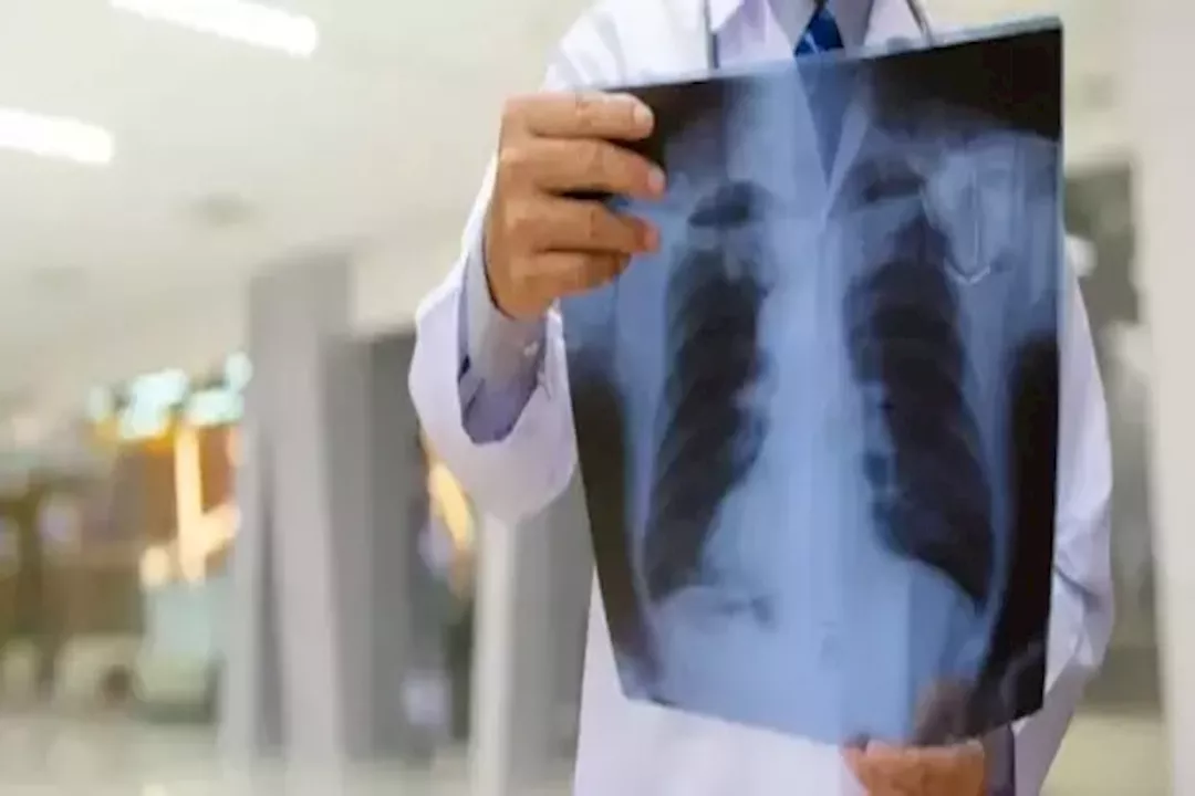 ما هى الأمراض التي تسبب ارتشاح المياه في الرئة؟