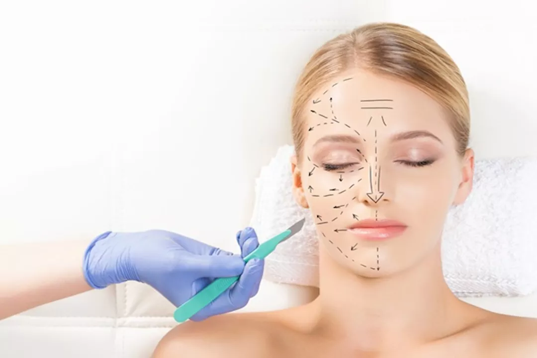 هل عمليات التجميل تغير شكل الوجه؟- طبيبة تجيب "فيديو"