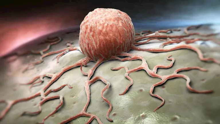 تناولها في رمضان.. 7 أطعمة تحارب السرطان وتقوي المناعة 