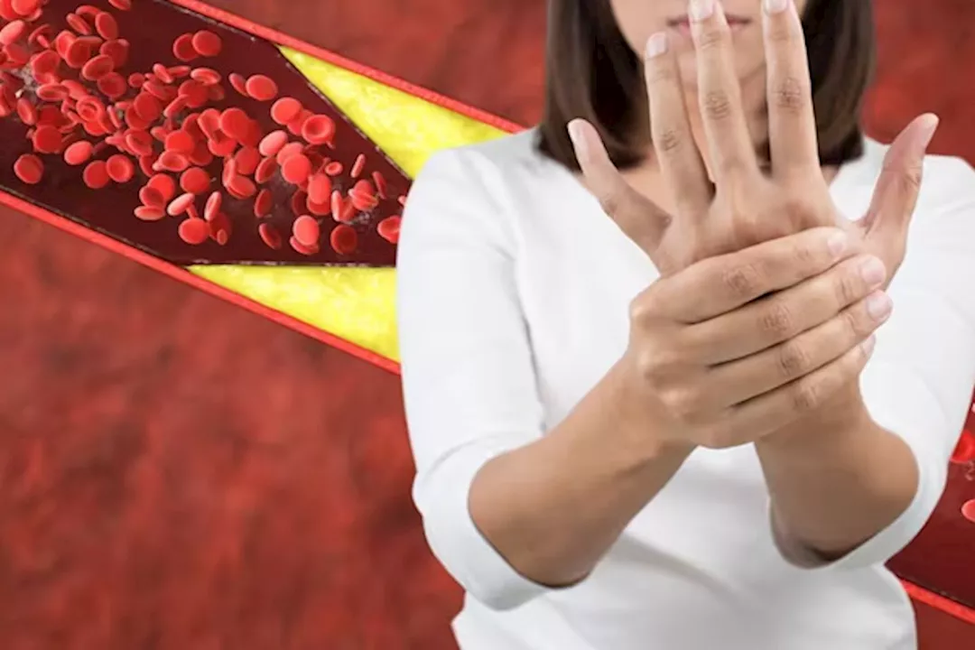 علامات ارتفاع الكوليسترول- 5 أعراض تظهر على أصابع اليدين ليلًا