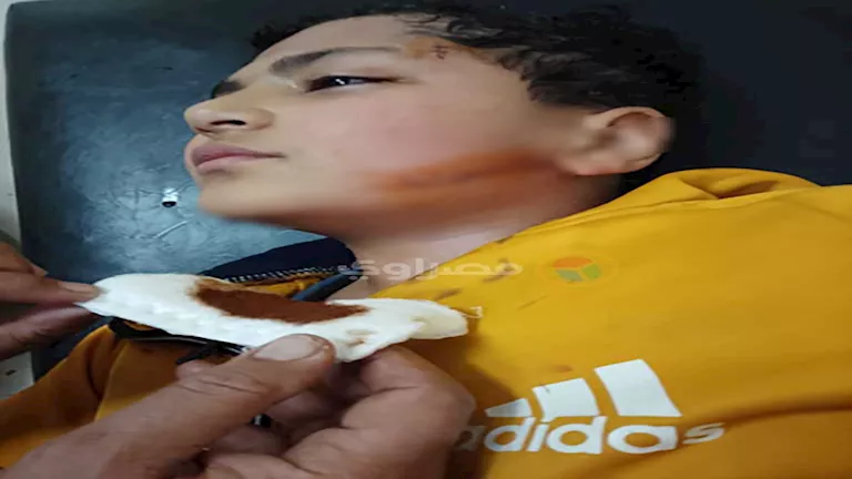 طفل يضرب طفل آخر بكتر في مسجد