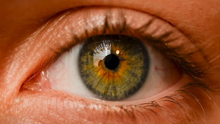 ما أسباب حرقان العين بشكل مستمر؟ إليك الأسباب وطرق العلاج 