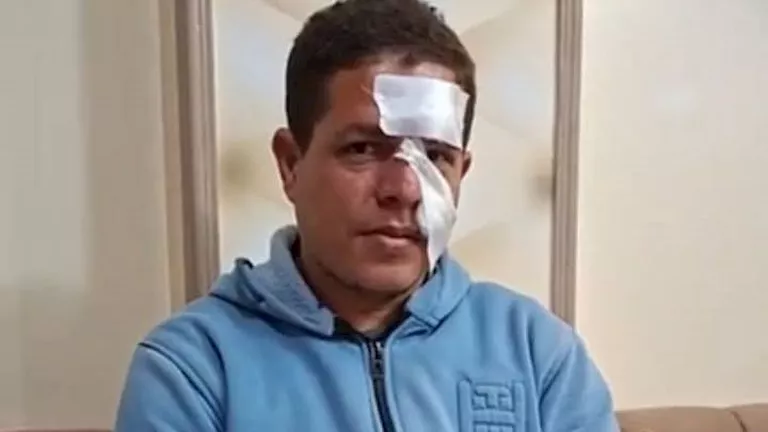 15 غرزة في الوجه.. القصة الكاملة لواقعة تعدي طالب على معلم بالدقهلية