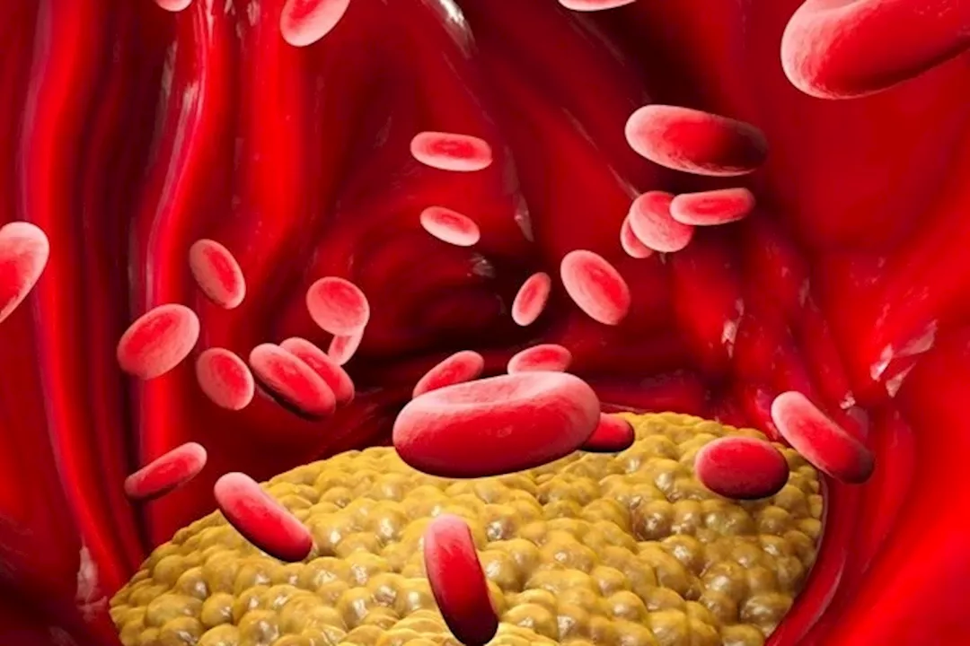 علاج الدهون الثلاثية في البيت- تناول هذا العصير بشكل يومي