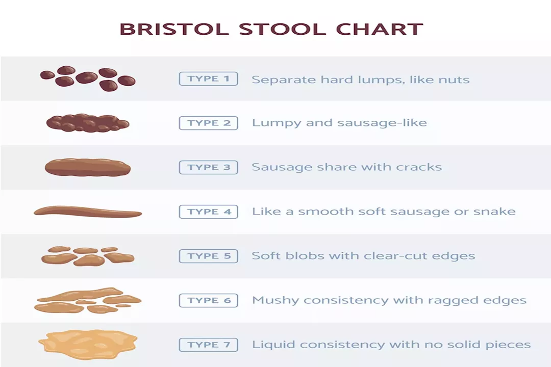 Bristolstoolchart_GettyImages-1319087364-9c833d66ff614e6ca1f874a5224fa12f