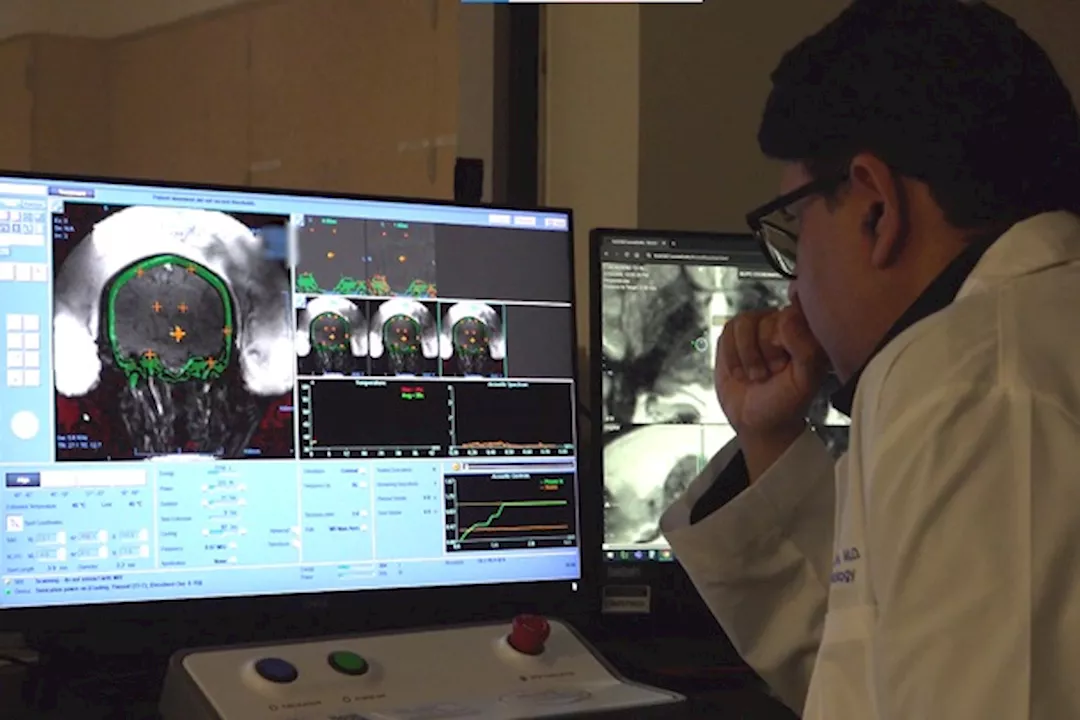 brainimaging