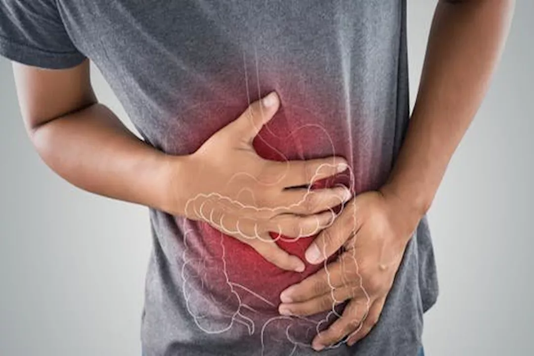 نقص فيتامين B12.. علامة تحذيرية لمرضى القولون التقرحي؟ 