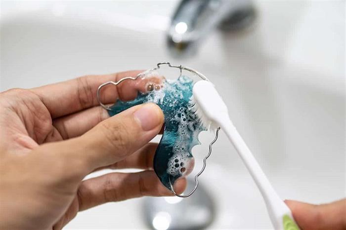 طبيب يحذر: عدم تنظيف الأسنان بعد تركيب التقويم يسبب هذه الأمراض